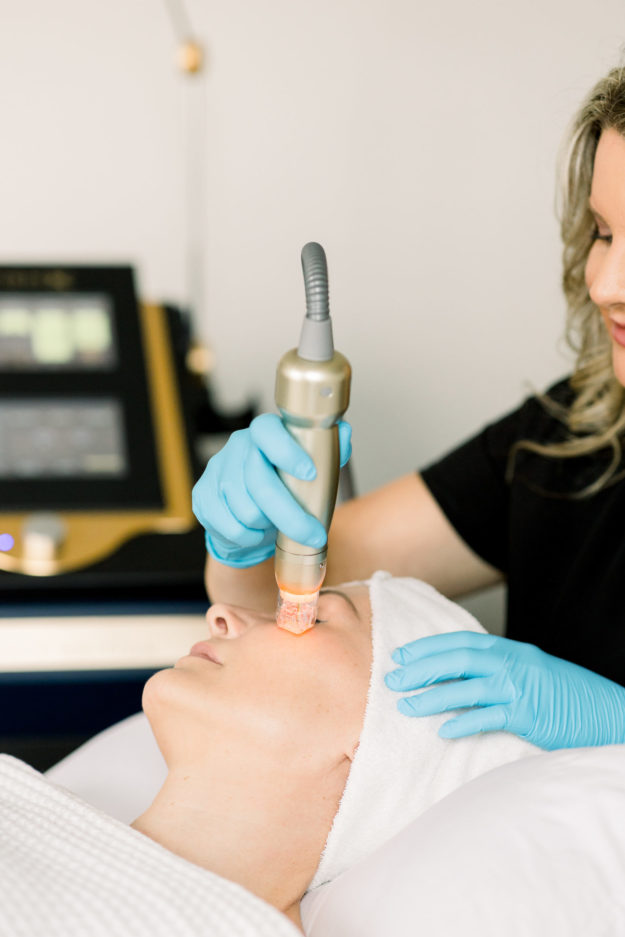 MICRONEEDLING WITH RADIO FREQUENCY