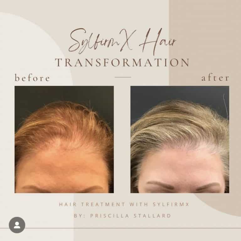 Before And After Hair Transformation | Clarksville, TN | Bella Med Spa