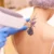 Tattoo Removal by Bella Medical Spa in CLARKSVILLE, TN