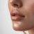 Kybella Treatment for chin at Bella Med Spa