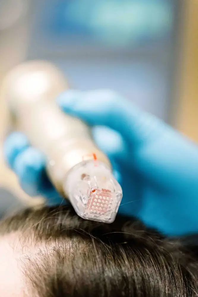 SylfirmX Hair Treatment
