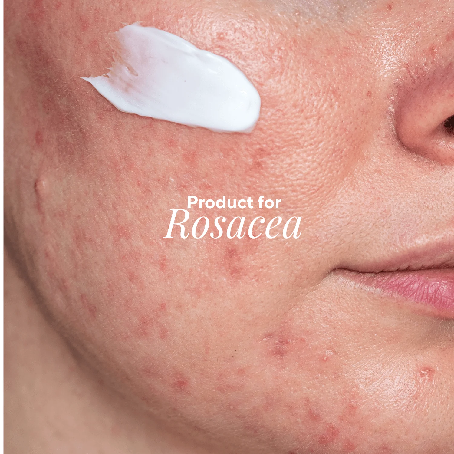 Rosa Cream