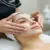 Top 7 Reasons Why Chemical Peels Are Effective for Acne Treatment