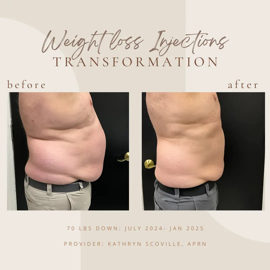 Copy-of-Brown-Customer-before-and-after-A-in-Clarksville-Tn