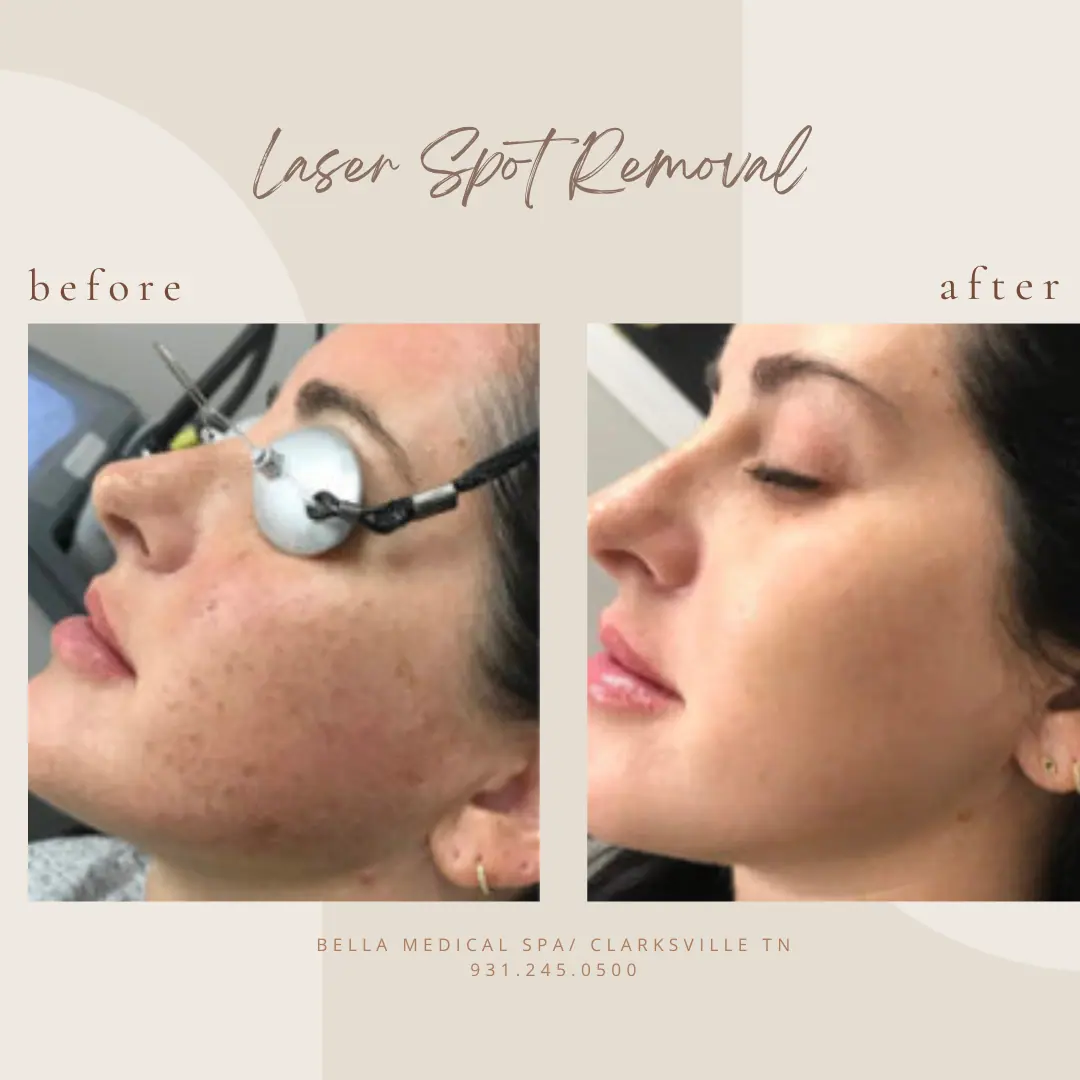 Copy-of-Brown-Customer-before-and-after-Instagram-Post-1-In Clarksville-TN