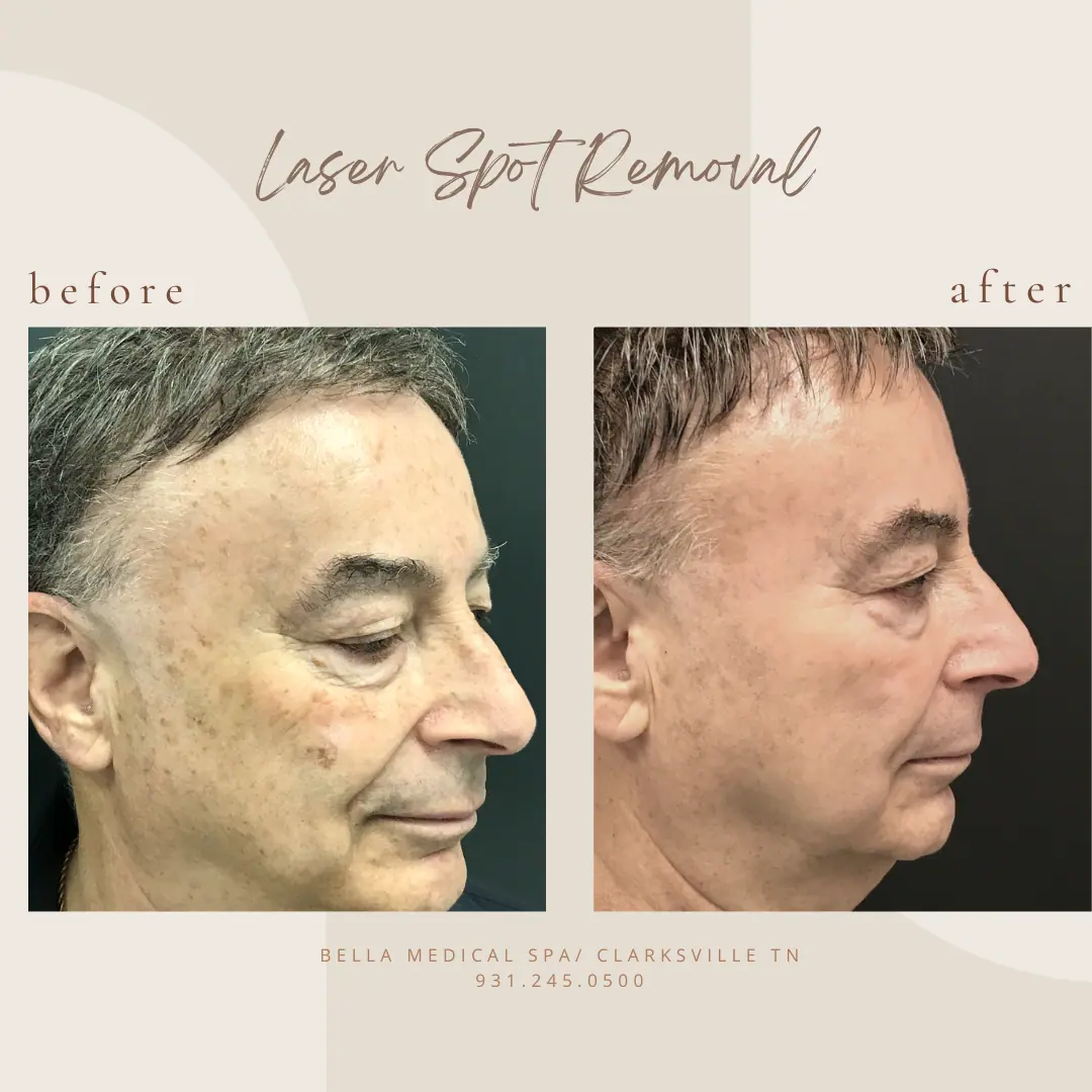 Copy-of-Brown-Customer-before-and-after-Instagram-Post-2-In Clarksville-TN