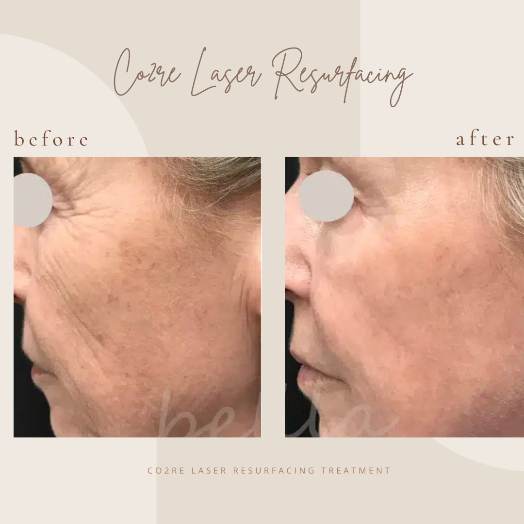 Copy-of-Brown-Customer-before-and-after-Instagram-Post-In Clarksville-TN