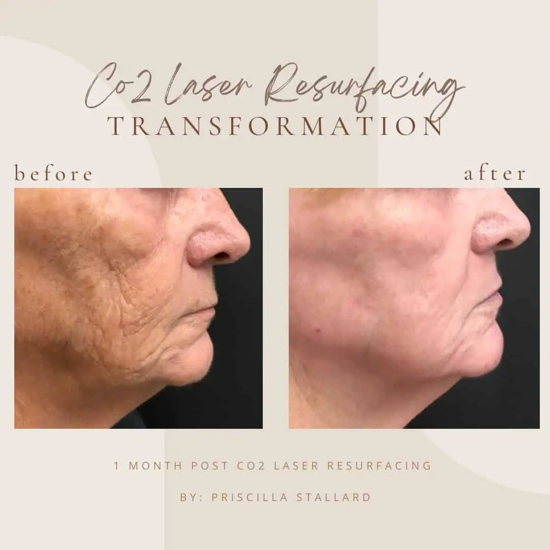 Copy-of-Brown-Customer-before-and-after-Instagram-Post-Instagram-Post-1-In Clarksville-TN