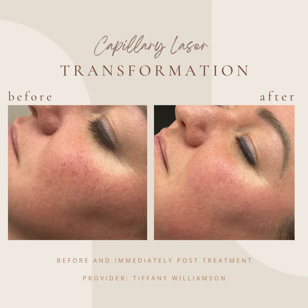 Copy-of-Brown-Customer-before-and-after-Instagram-Post-Instagram-Post-27-In Clarksville-TN