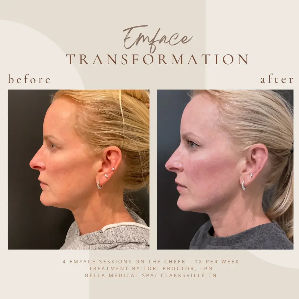 Copy-of-Brown-Customer-before-and-after-Instagram-Post-Instagram-Post-3-In-Clarksville-TN-a--