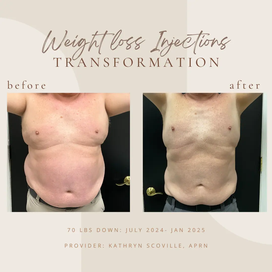 Copy-of-Brown-Customer-before-and-after-in-Clarksville-Tn