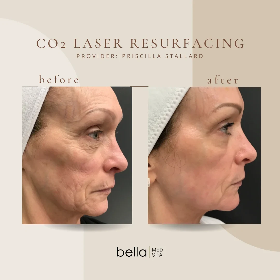 co2-1-In Clarksville-TN