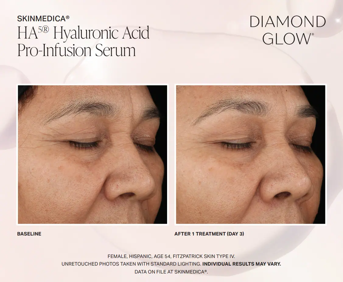 facial-treatment-Abefore-and-after-In Clarksville-TN