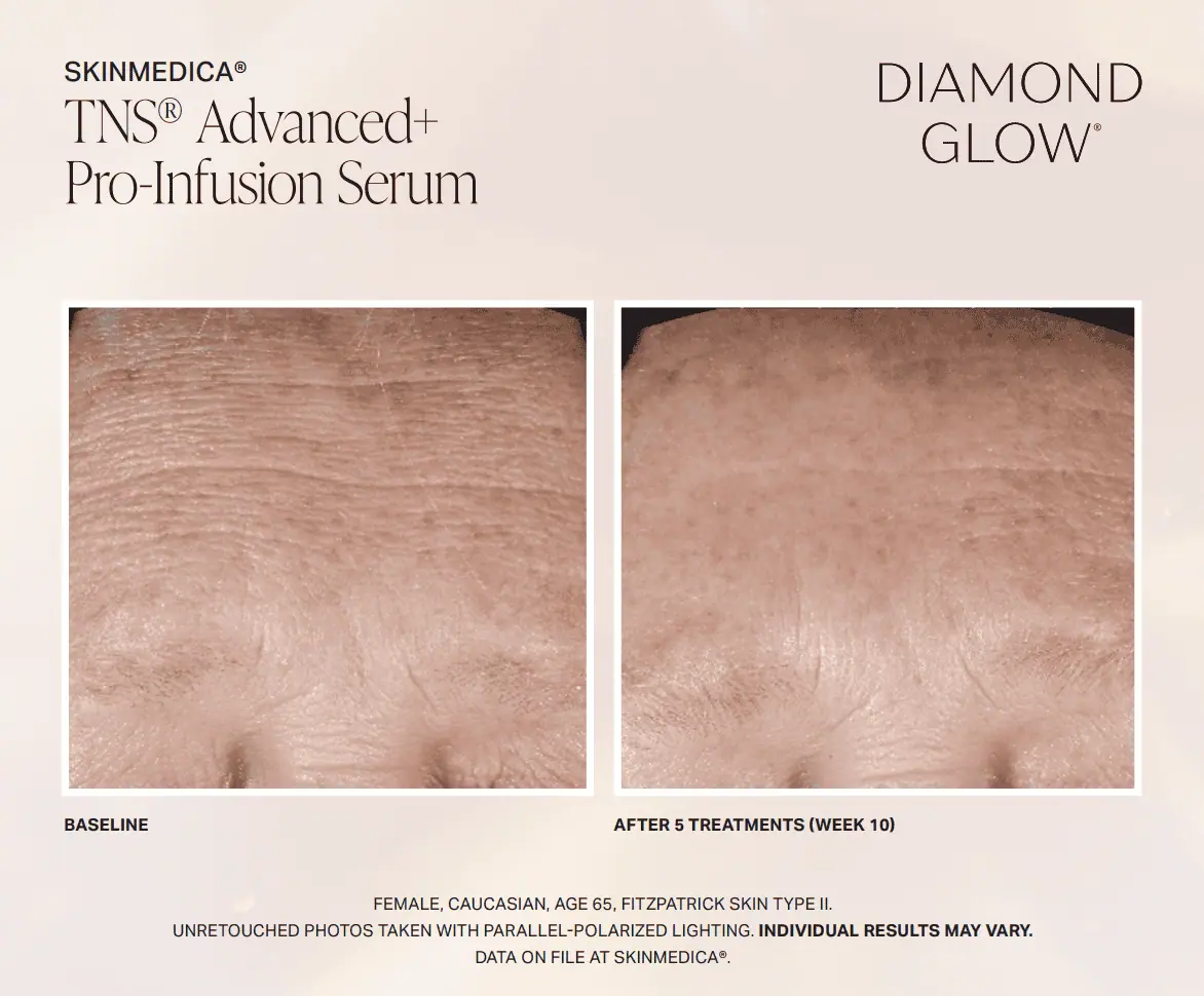 facial-treatment-Bbefore-and-after-In Clarksville-TN