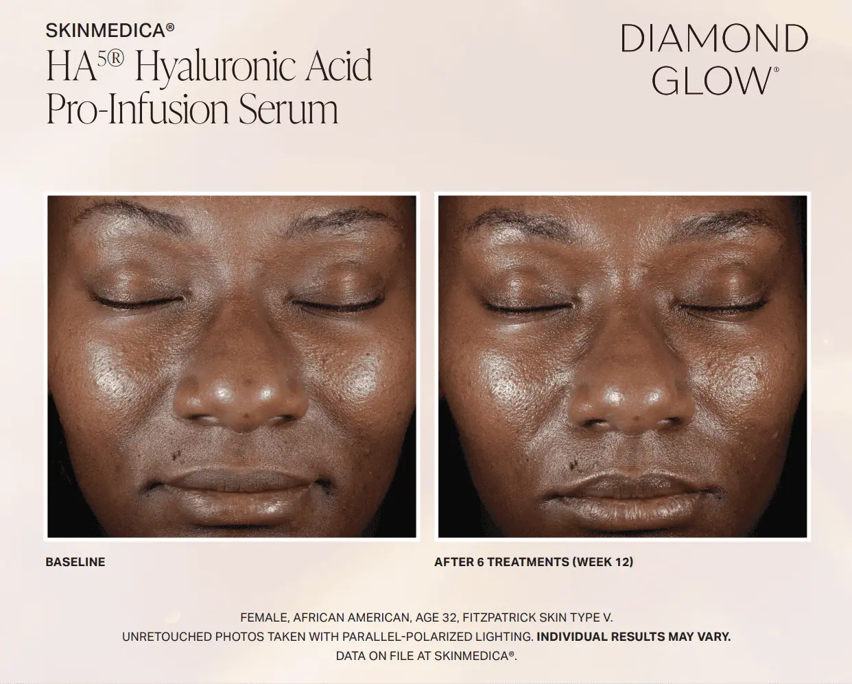 facial-treatmentbefore-and-after-In Clarksville-TN