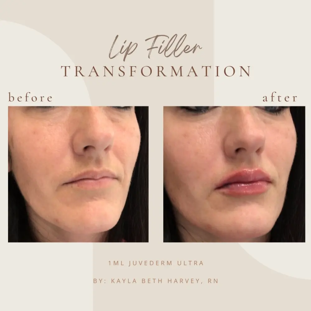 filler-KB-Ain-Clarksville-Tn-a–