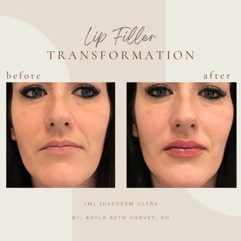 filler-kb-Bin-Clarksville-Tn-a–