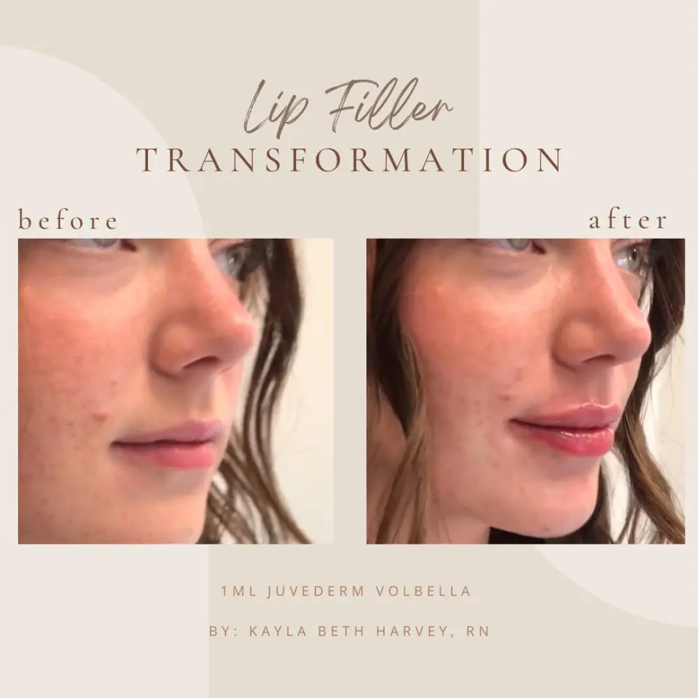 filler-kb-Cin-Clarksville-Tn-a–