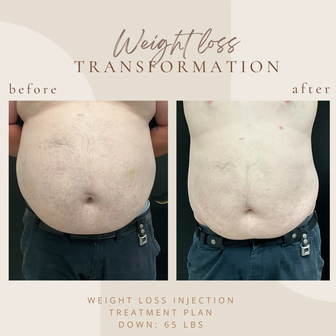 weightloss-A-in-Clarksville-Tn