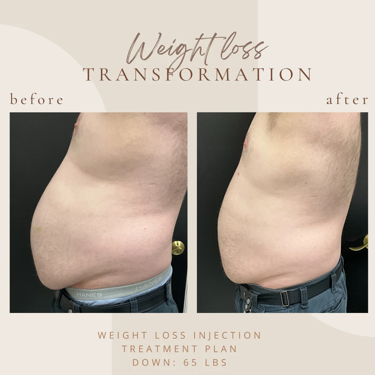 weightloss-B-in-Clarksville-Tn
