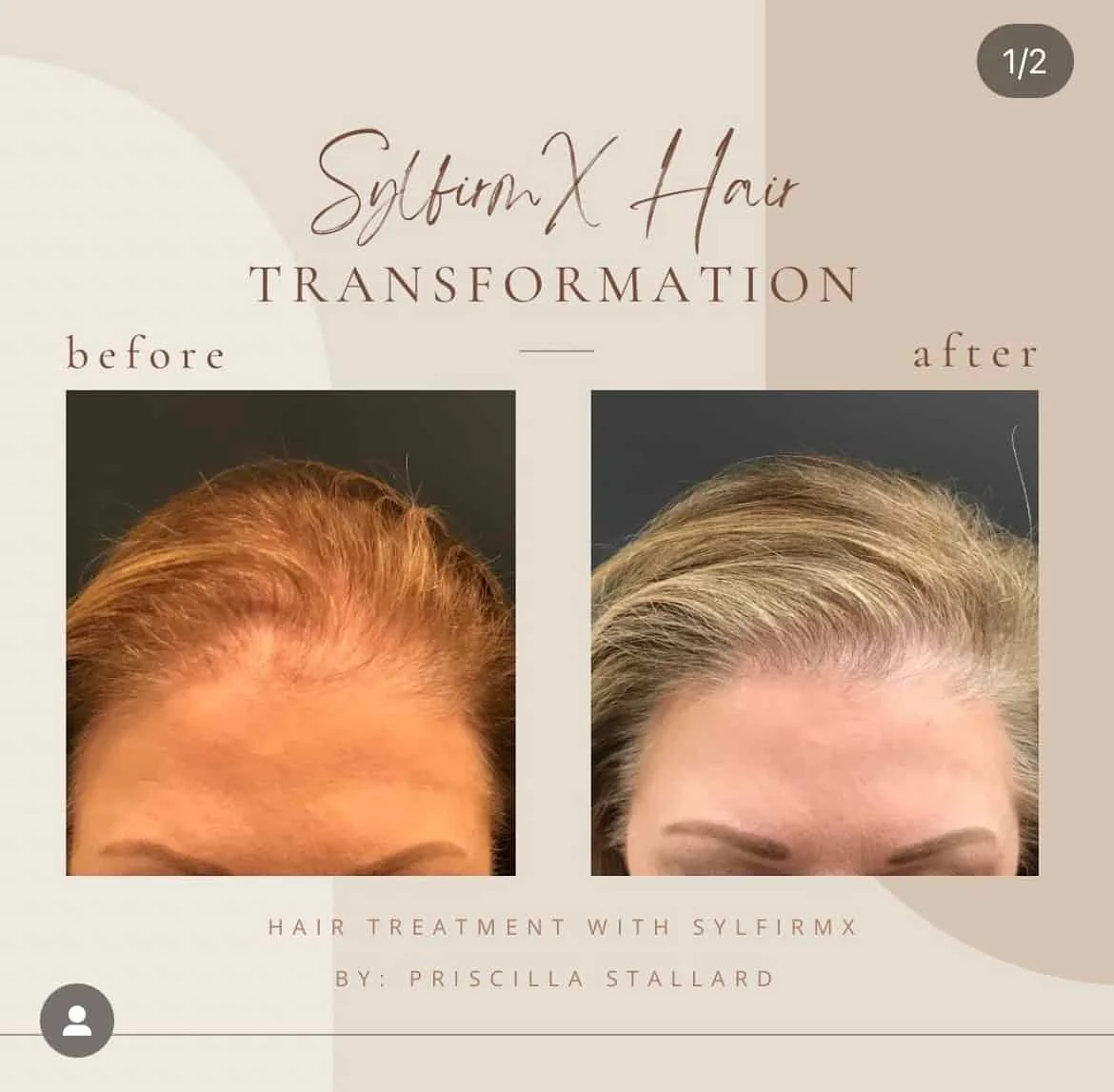 x-hair-Ain-Clarksville-Tn