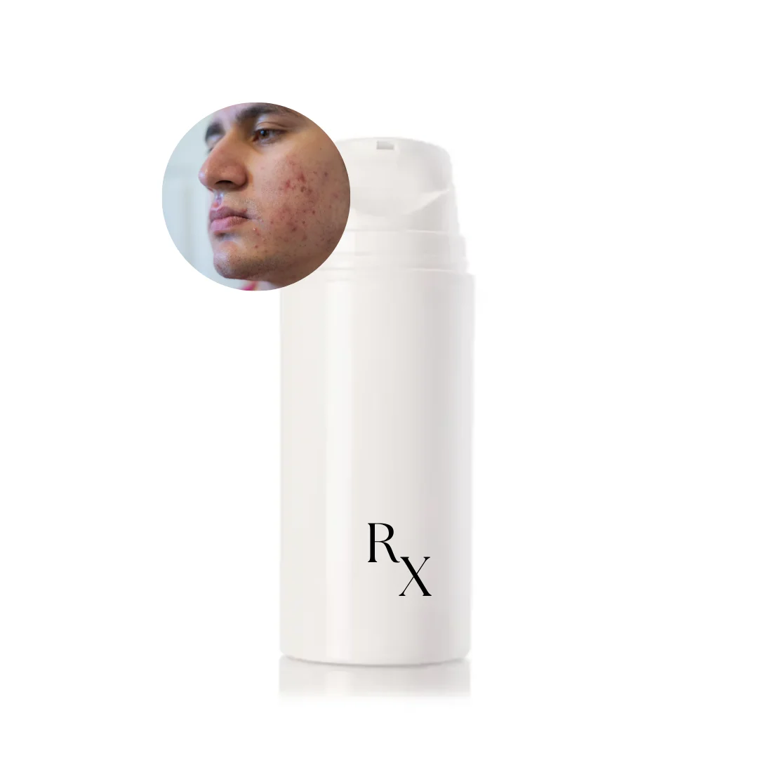 Clear Revive Blemish Cream | Bella Med Spa In Clarksville, TN