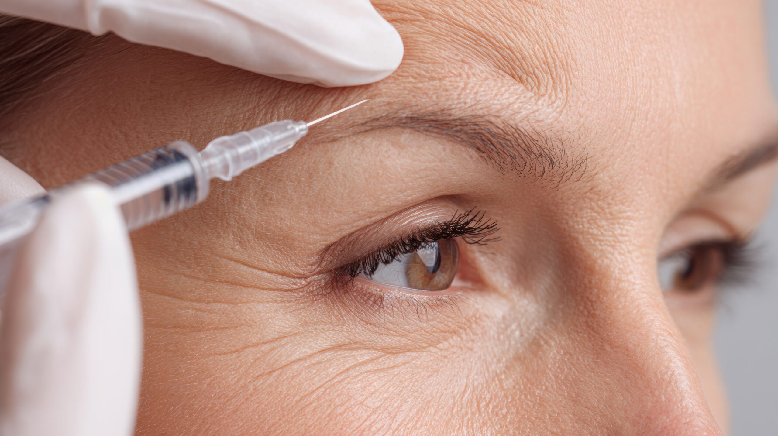 Botox for Forehead Lines: What to Expect