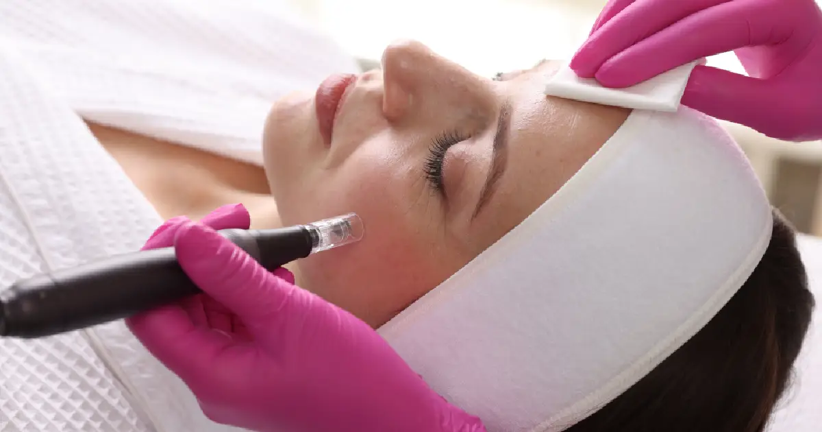 7 Skin Concerns SylfirmX Microneedling with RF Can Help Improve