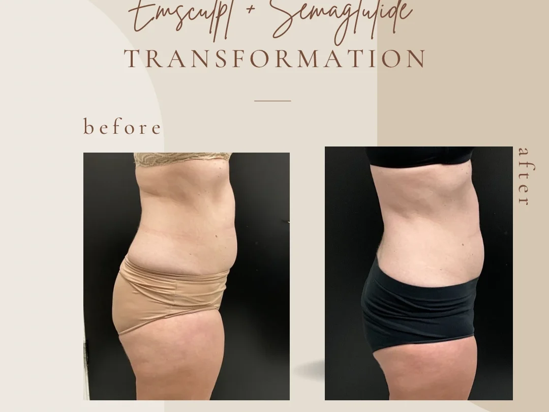 Emsculpt and Semaglutide at Bella Med Spa