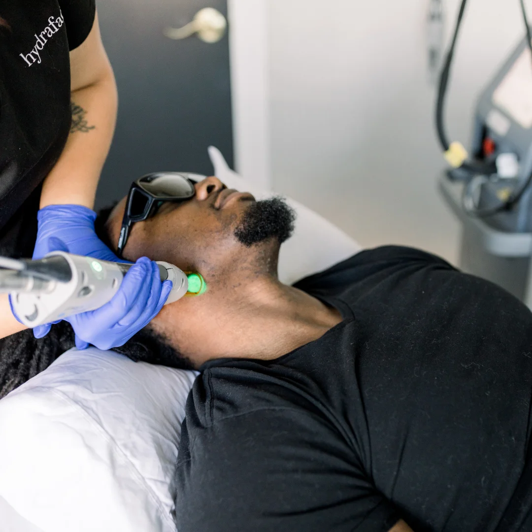 Laser Hair Treatment at Bella Med Spa