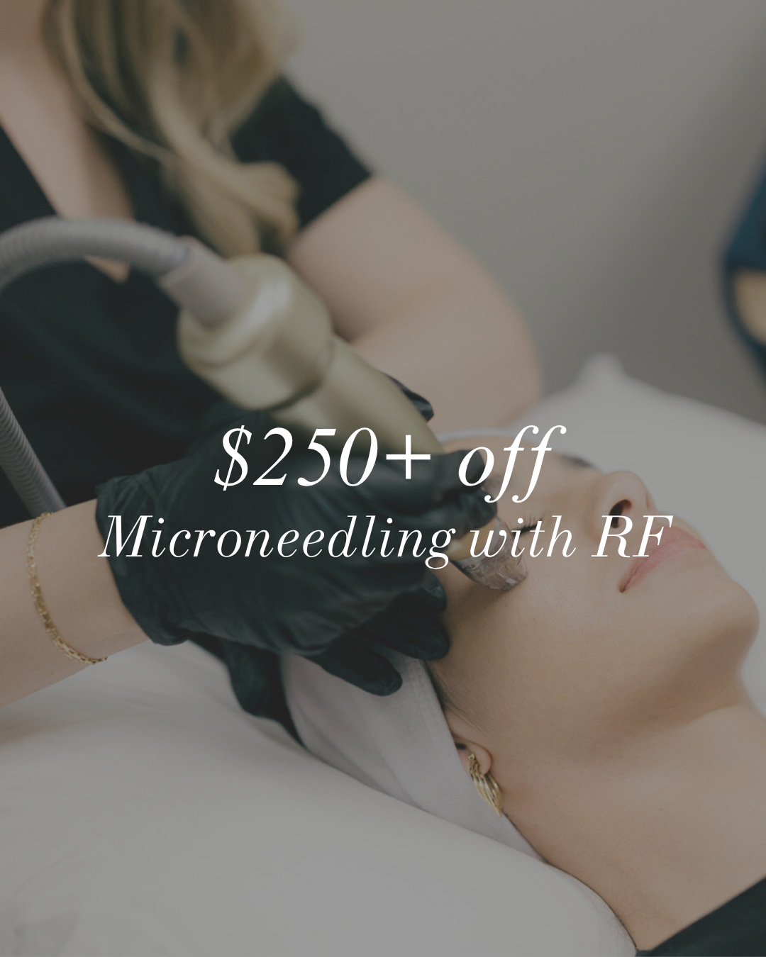 Sylfirm X - Mirconeedling with Radio Frequency & Exosome Booster