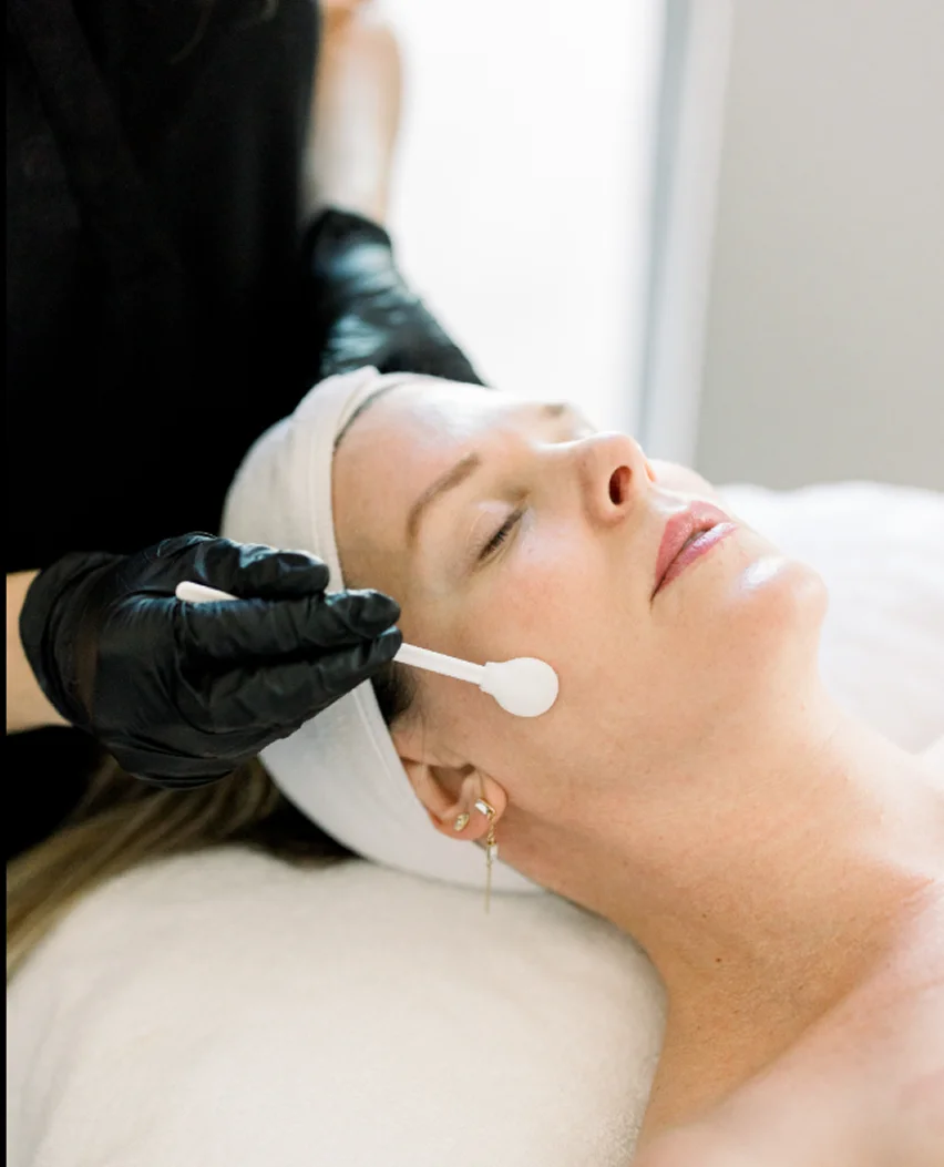 Chemical Peels in Clarksville Tn - Bella Med Spa