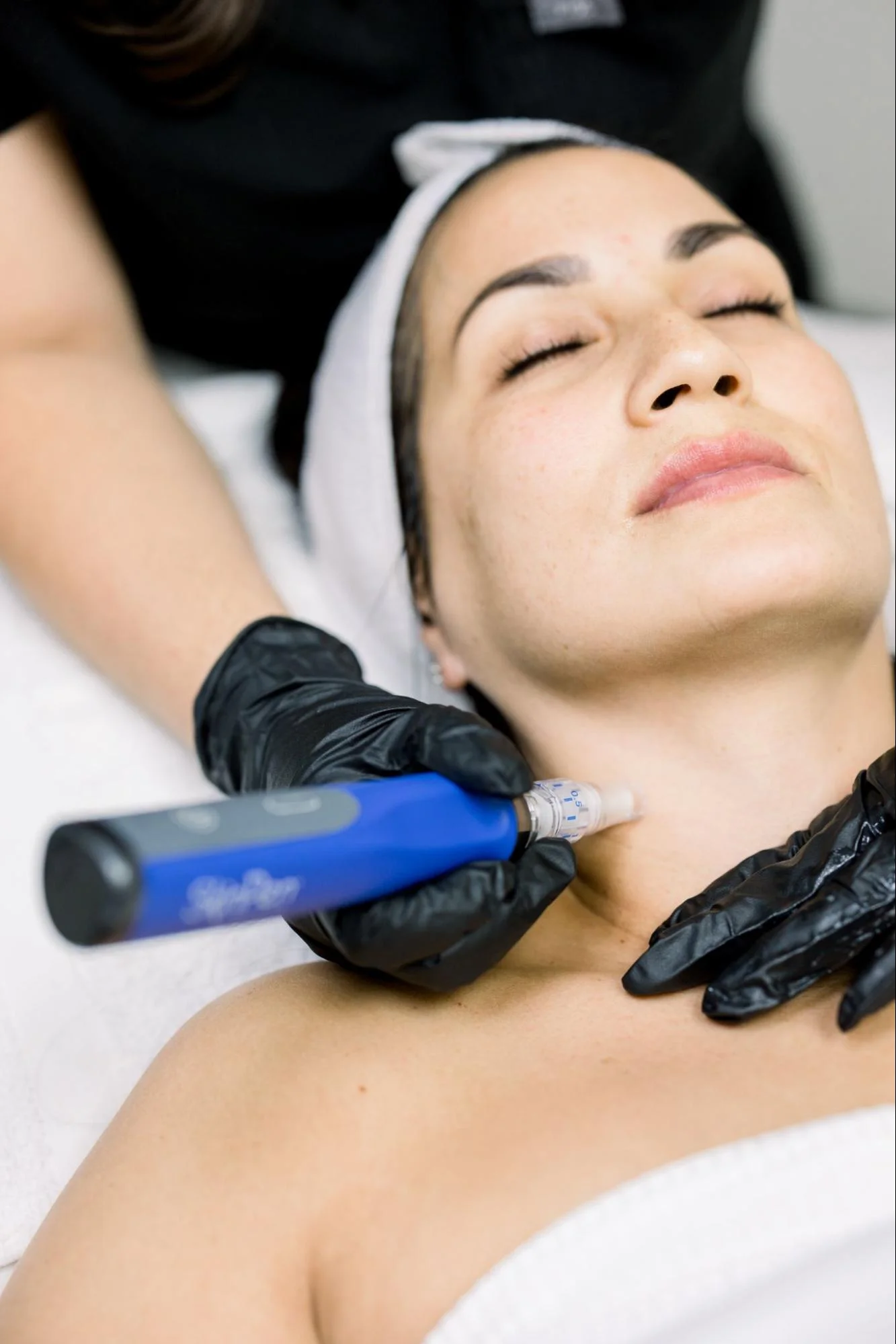 Microneedling Treatment in Clarksville TN at Bella Med Spa