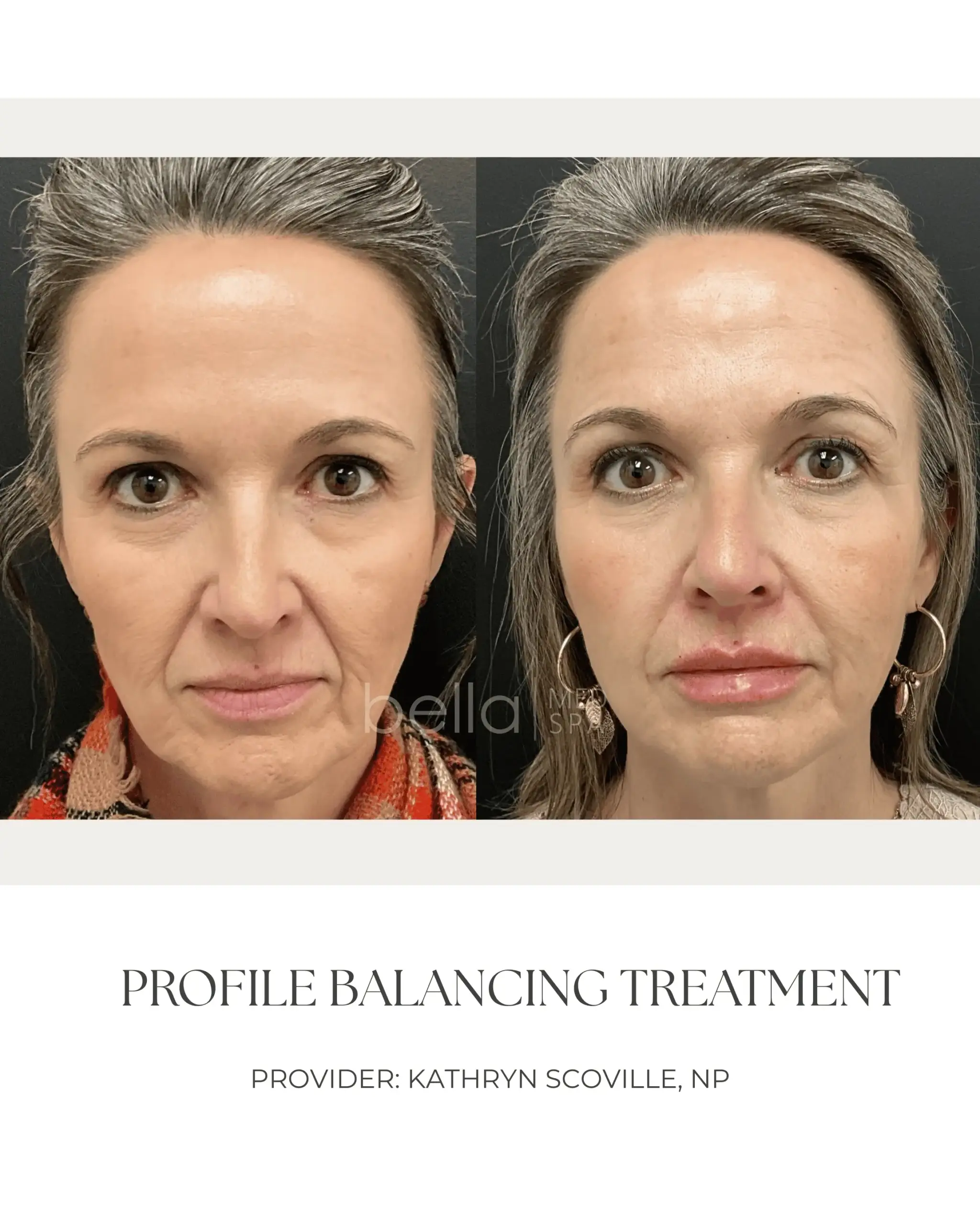 Profile Balancing Treatment