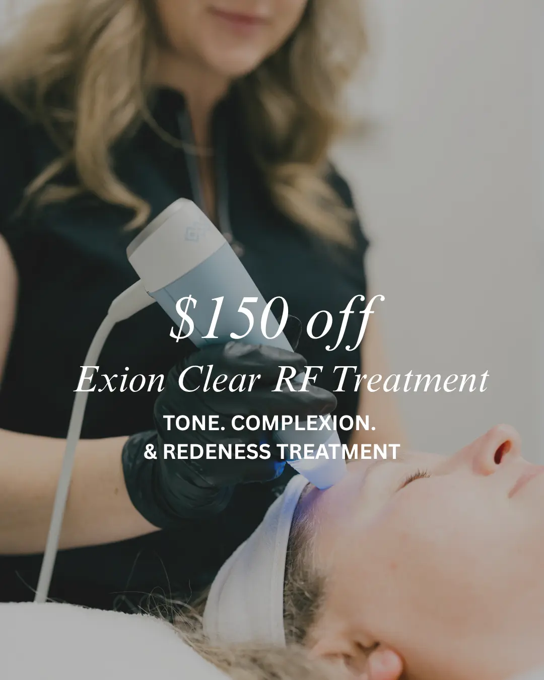 Exion Clear RF Treatment